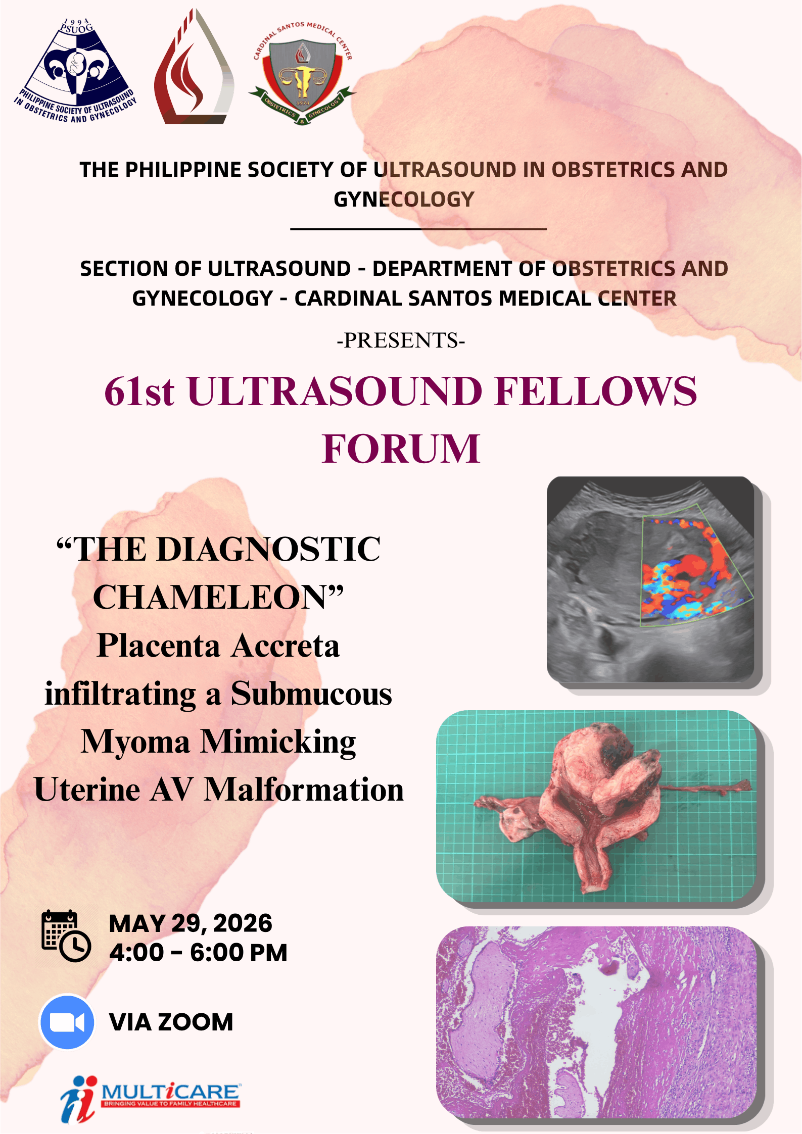 61st Ultrasound Fellow’s Forum Poster